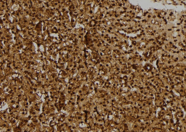 R3HCC1L Antibody in Immunohistochemistry (Paraffin) (IHC (P))