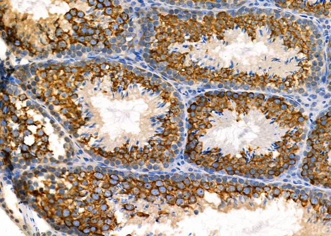 GAS1 Antibody in Immunohistochemistry (Paraffin) (IHC (P))