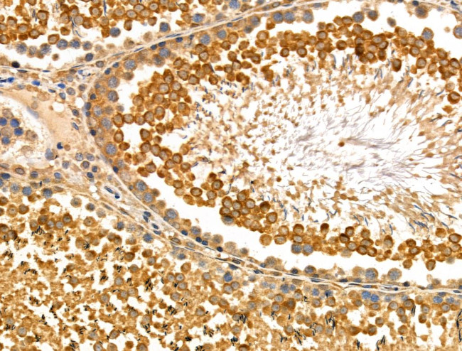 SAR1B Antibody in Immunohistochemistry (Paraffin) (IHC (P))