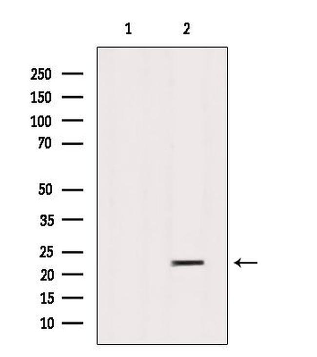 SAR1B Antibody in Western Blot (WB)