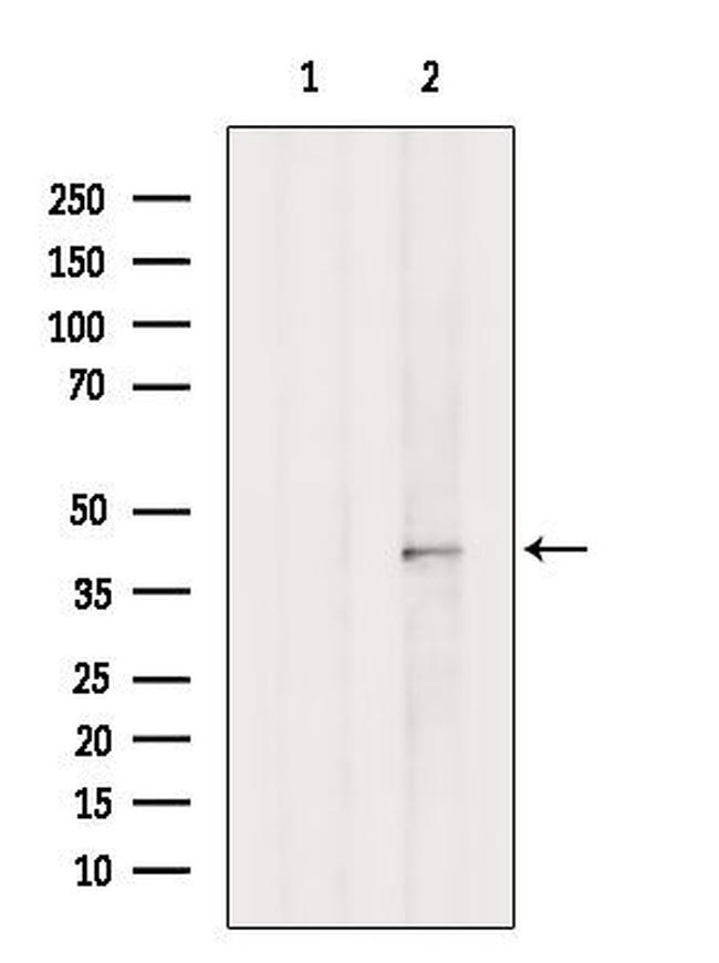 HOXA5 Antibody in Western Blot (WB)