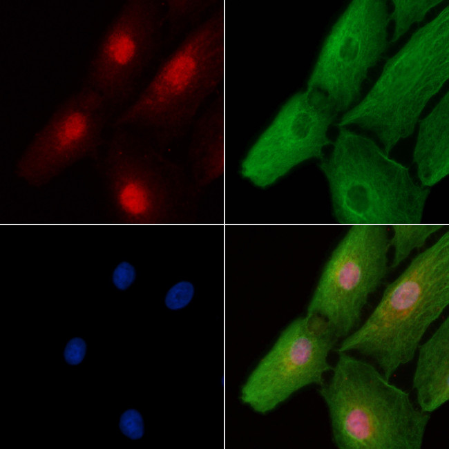 SIX1 Antibody in Immunocytochemistry (ICC/IF)