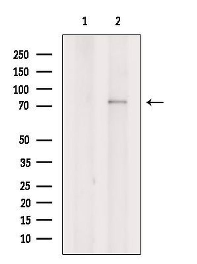 SIX5 Antibody in Western Blot (WB)