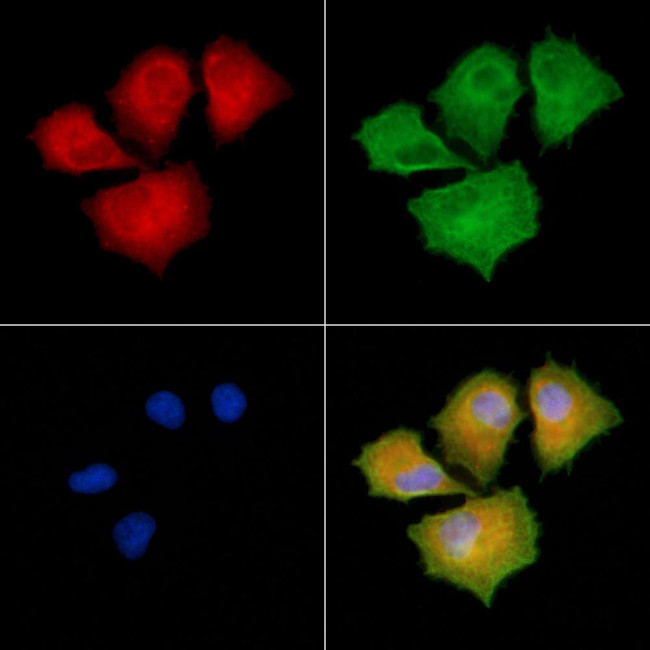 AASDHPPT Antibody in Immunocytochemistry (ICC/IF)