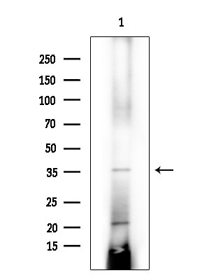 AASDHPPT Antibody in Western Blot (WB)