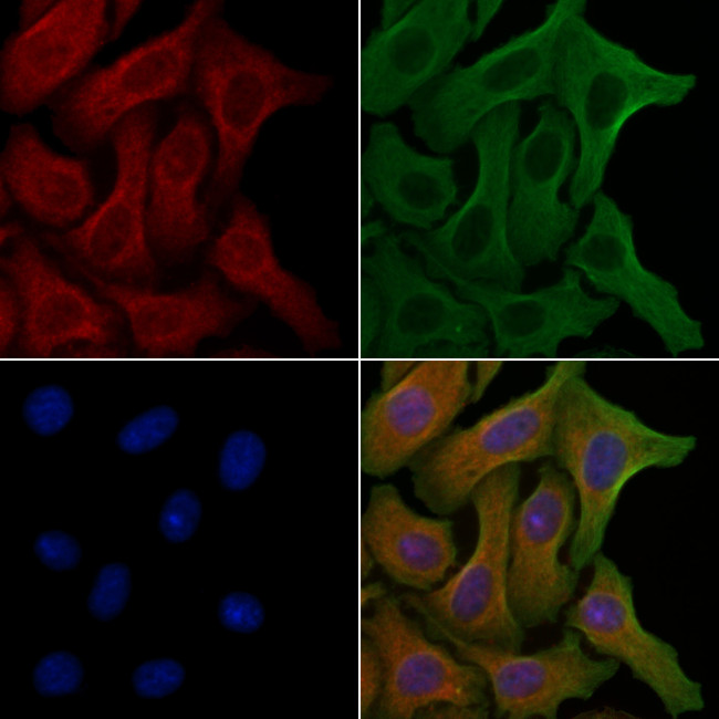 CEP97 Antibody in Immunocytochemistry (ICC/IF)