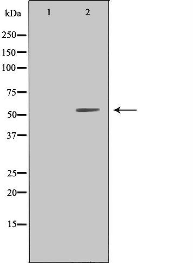 LILRA1 Antibody in Western Blot (WB)