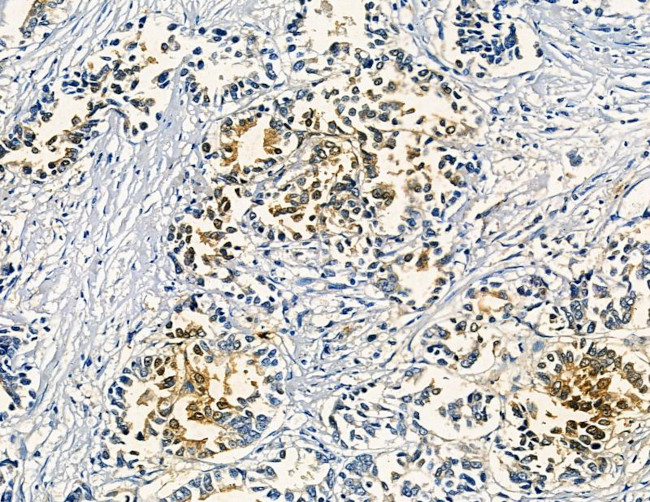 LILRA2 Antibody in Immunohistochemistry (Paraffin) (IHC (P))