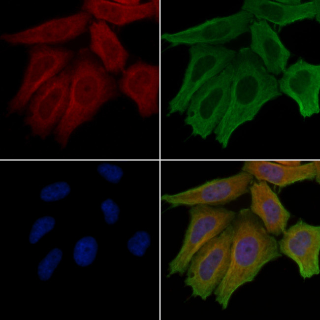 LIPI Antibody in Immunocytochemistry (ICC/IF)