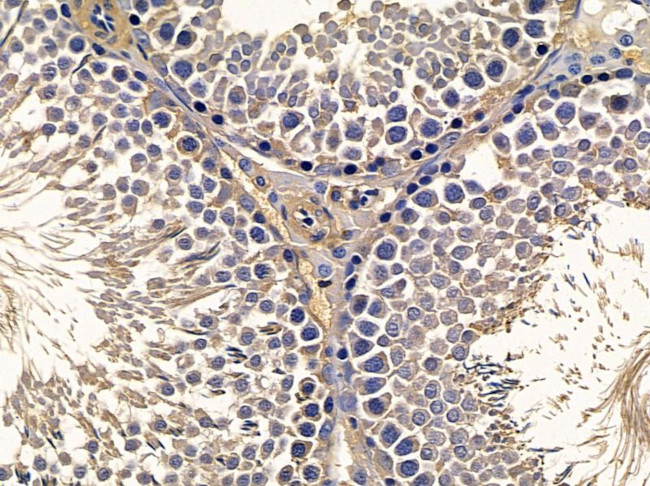 LIPI Antibody in Immunohistochemistry (Paraffin) (IHC (P))