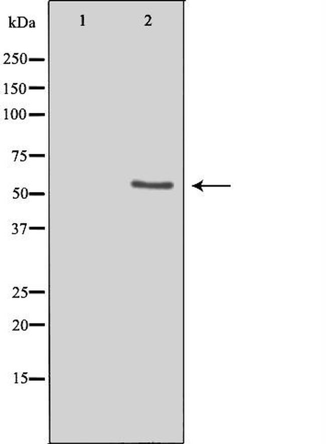 LIPI Antibody in Western Blot (WB)