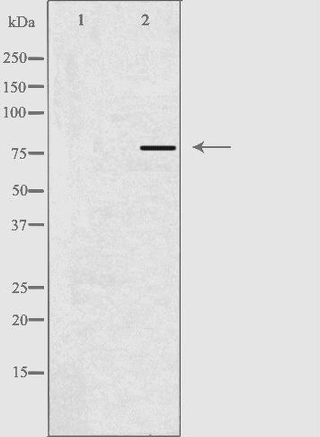 ACSL6 Antibody in Western Blot (WB)