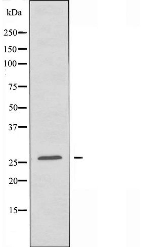 LDLRAD1 Antibody in Western Blot (WB)