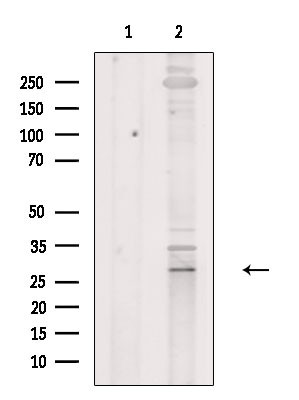 CD58 Antibody in Western Blot (WB)