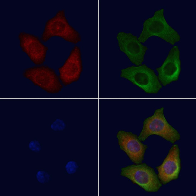 CD206 Antibody in Immunocytochemistry (ICC/IF)