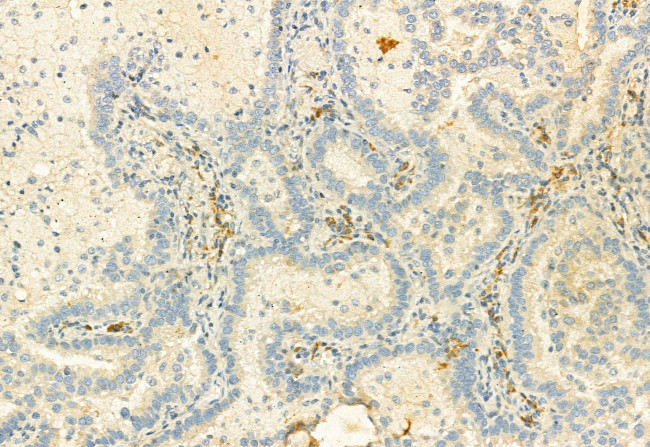 CD206 Antibody in Immunohistochemistry (Paraffin) (IHC (P))