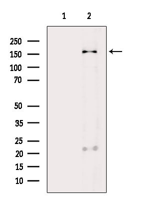 CD206 Antibody in Western Blot (WB)