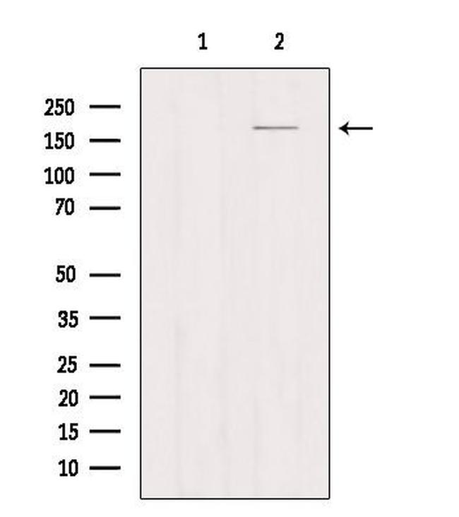 CD206 Antibody in Western Blot (WB)