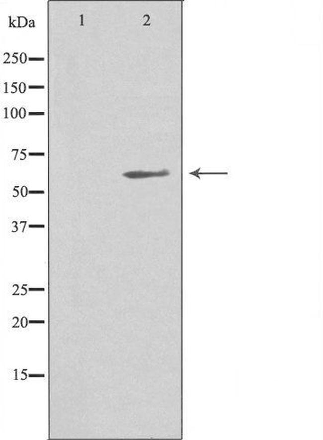 CTAGE5 Antibody in Western Blot (WB)