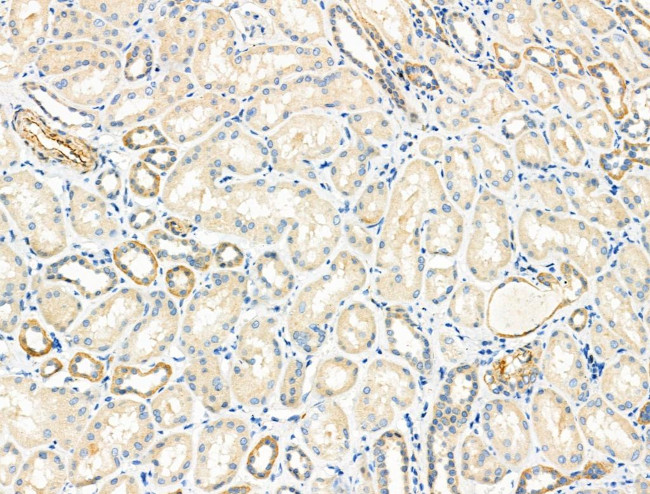 SLC25A21 Antibody in Immunohistochemistry (Paraffin) (IHC (P))