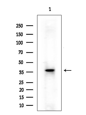 SLC25A21 Antibody in Western Blot (WB)