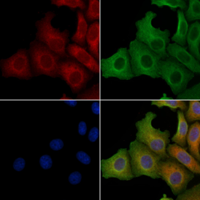 SLC25A11 Antibody in Immunocytochemistry (ICC/IF)