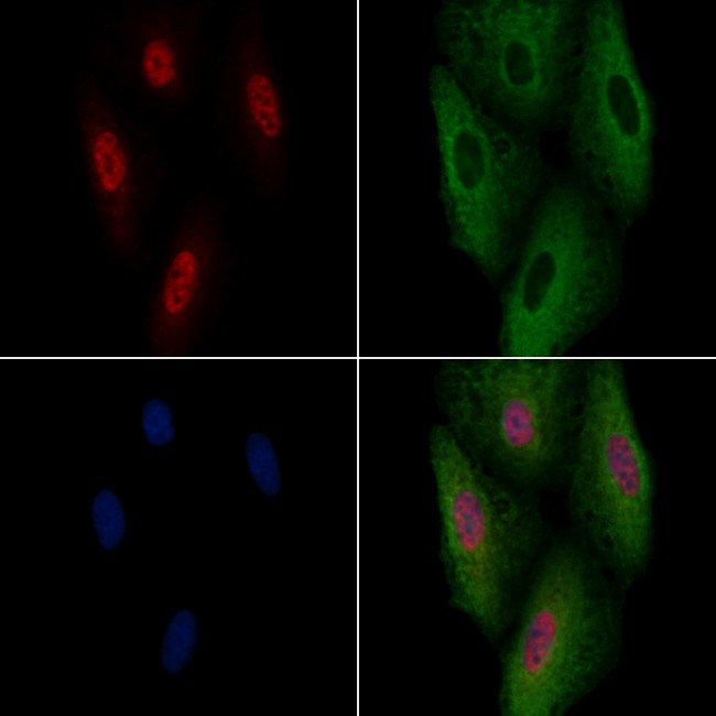 MDFI Antibody in Immunocytochemistry (ICC/IF)