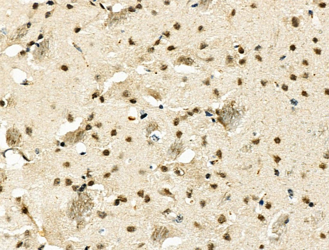 MDFI Antibody in Immunohistochemistry (Paraffin) (IHC (P))