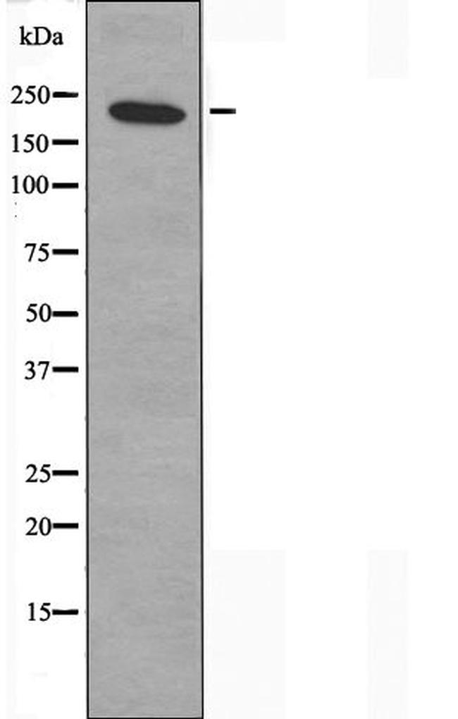 MYH14 Antibody in Western Blot (WB)