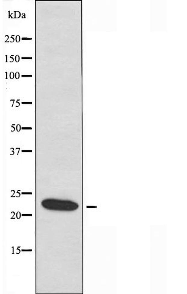 NDUFB10 Antibody in Western Blot (WB)