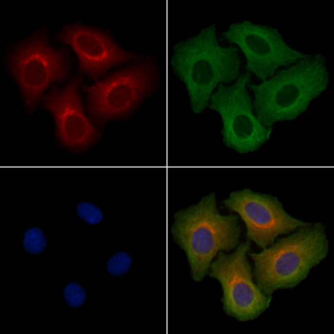 PTGR1 Antibody in Immunocytochemistry (ICC/IF)