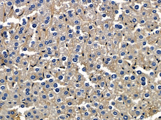 PTGR1 Antibody in Immunohistochemistry (Paraffin) (IHC (P))