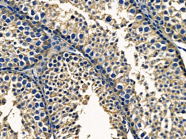 PTGR1 Antibody in Immunohistochemistry (Paraffin) (IHC (P))