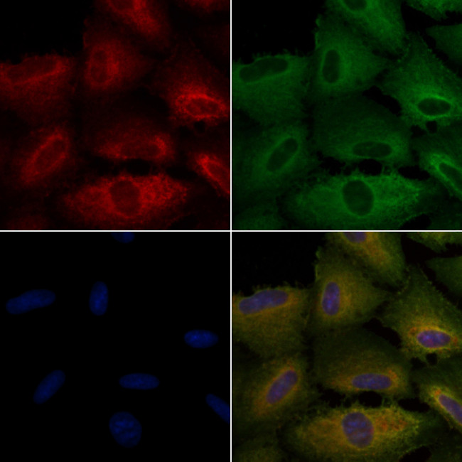 NOX5 Antibody in Immunocytochemistry (ICC/IF)