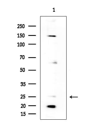 NPDC1 Antibody in Western Blot (WB)