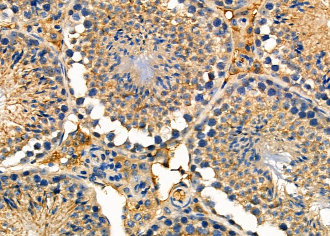 NXPH1 Antibody in Immunohistochemistry (Paraffin) (IHC (P))