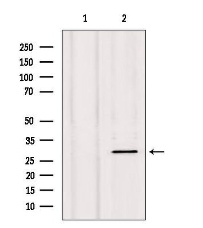 NXPH1 Antibody in Western Blot (WB)