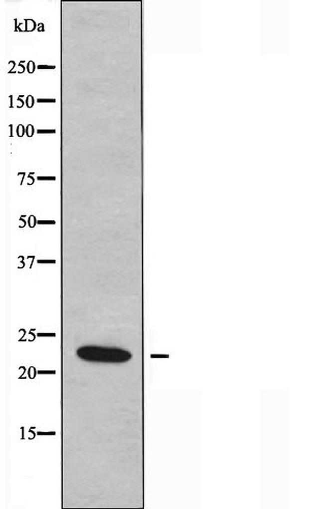 Neuromedin U-8 Antibody in Western Blot (WB)