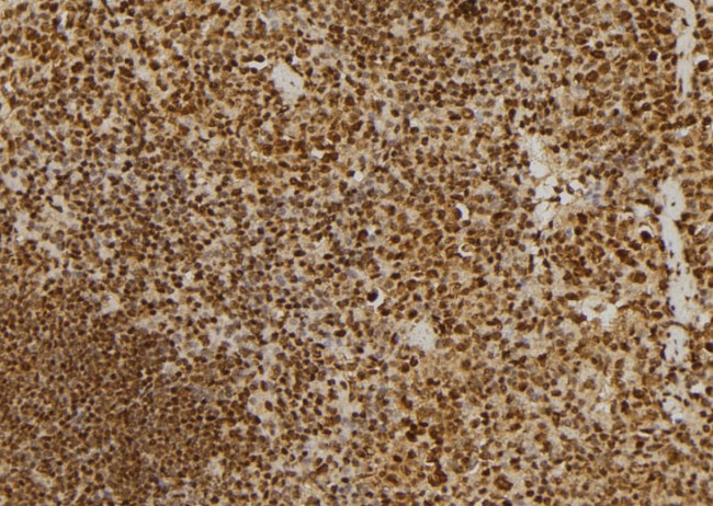 NuMA Antibody in Immunohistochemistry (Paraffin) (IHC (P))