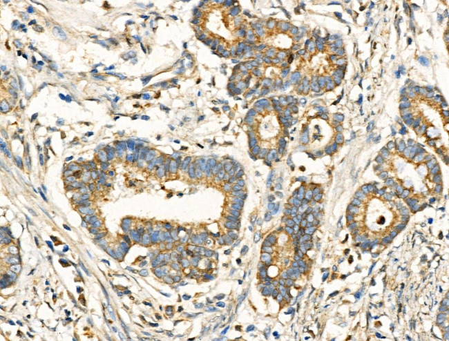 SLC15A1 Antibody in Immunohistochemistry (Paraffin) (IHC (P))