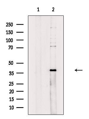 ZDHHC15 Antibody in Western Blot (WB)