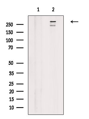 HELZ2 Antibody in Western Blot (WB)