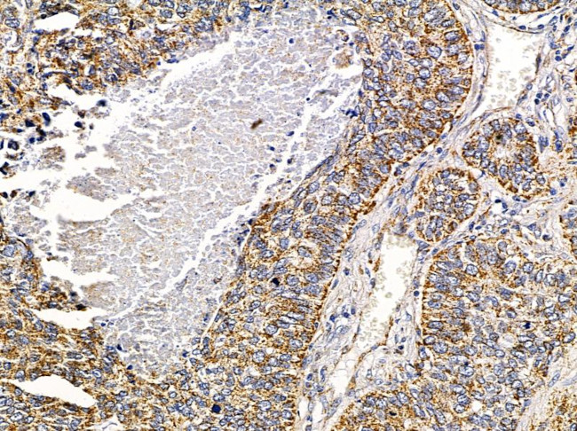 PHACTR4 Antibody in Immunohistochemistry (Paraffin) (IHC (P))