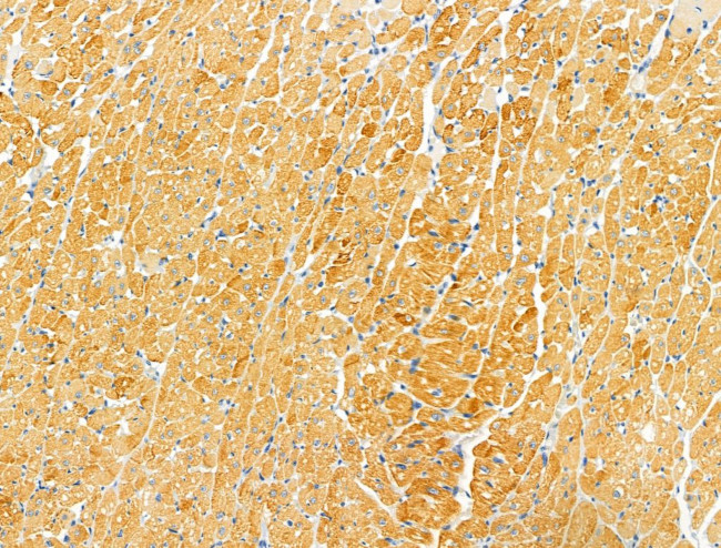 Protein C Inhibitor Antibody in Immunohistochemistry (Paraffin) (IHC (P))