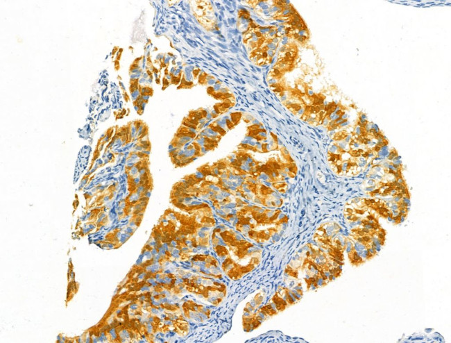 Protein C Inhibitor Antibody in Immunohistochemistry (Paraffin) (IHC (P))