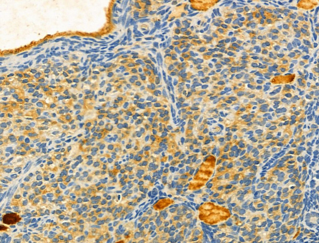 Protein C Inhibitor Antibody in Immunohistochemistry (Paraffin) (IHC (P))