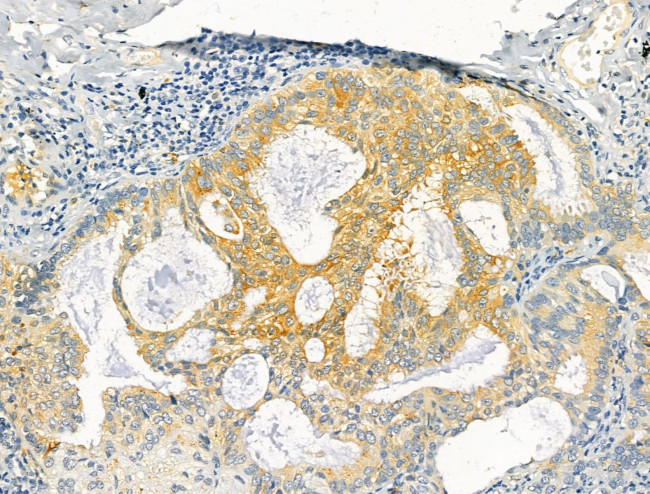 Protein C Inhibitor Antibody in Immunohistochemistry (Paraffin) (IHC (P))