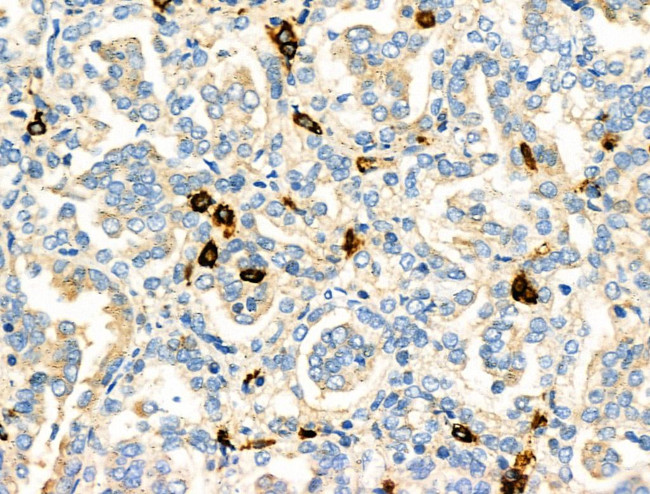 PABPC5 Antibody in Immunohistochemistry (Paraffin) (IHC (P))