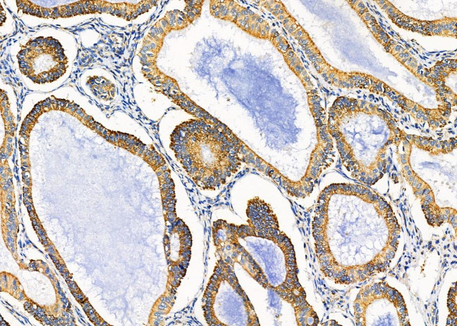 KCNK1 Antibody in Immunohistochemistry (Paraffin) (IHC (P))