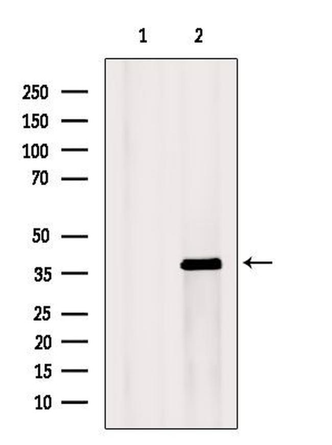 KCNK1 Antibody in Western Blot (WB)